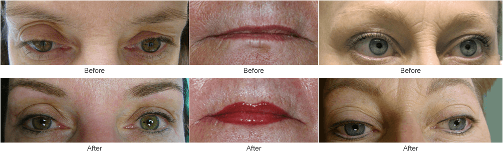 Lip, Eyeliner, & Eyebrow Tattooing: Permanement Cosmetics Photos